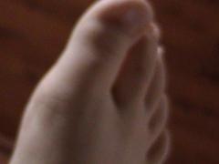 Tim's Foot